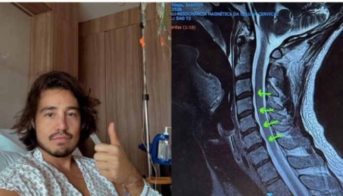 Tiago Iorc é internado com crise de hérnia de disco cervical