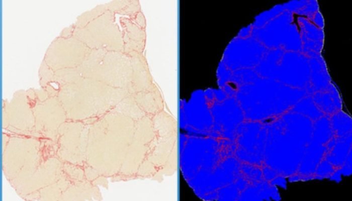 Descoberta Promissora na Luta Contra a Obesidade: Enzima-Chave Identificada
