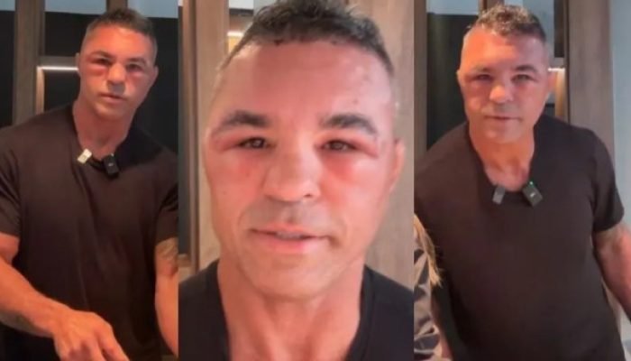 Vitor Belfort surge diferente e explica motivo nas redes sociais