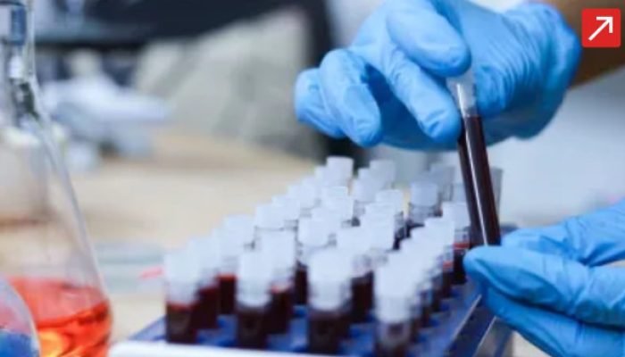 Doença faz homem ter nível de gordura no sangue 30 vezes acima do normal