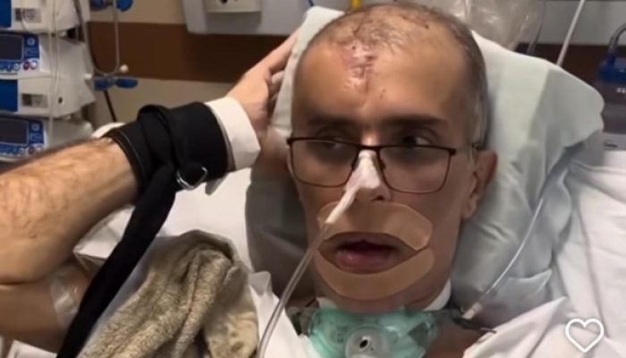 Comandante ferido no Rio reage a estímulos e emociona família