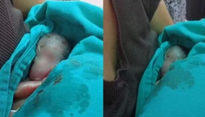 Bebê prematuro dado como morto é encontrado vivo em velório; caso é investigado no Acre