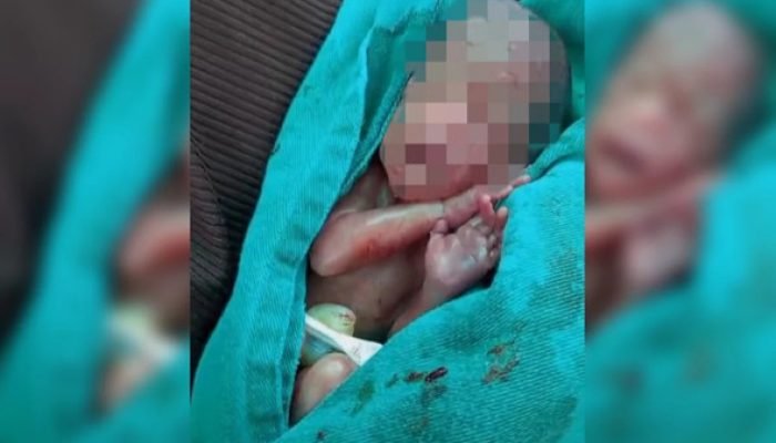 Morre bebê que chorou no próprio velório e foi retirado de caixão